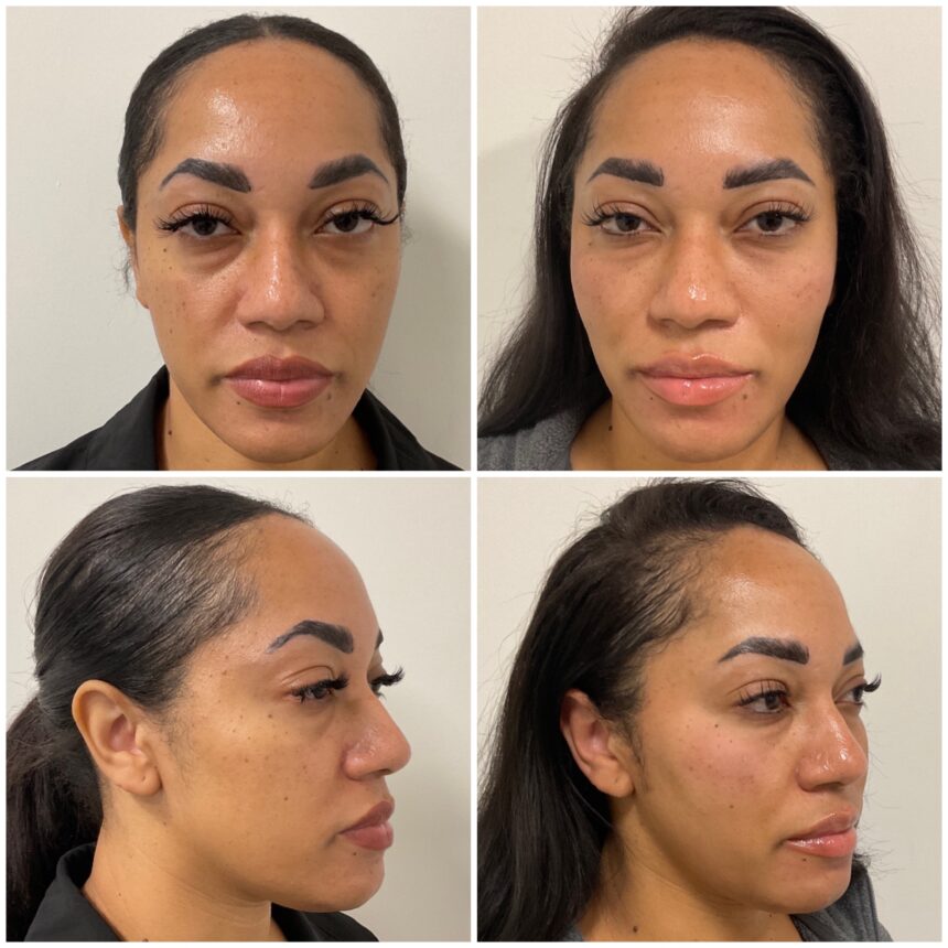 Why Eternia Medspa Is Changing the Standard